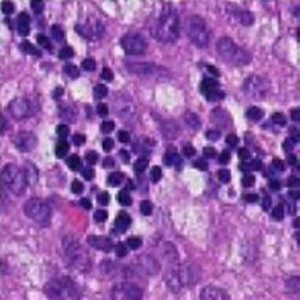 A stained tissue slide, from Patch Camelyon
