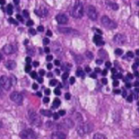Stained tissue under a microscope